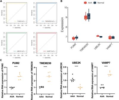 The abdominal aortic aneurysm-related disease model based on machine learning predicts immunity and m1A/m5C/m6A/m7G epigenetic regulation